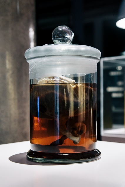 A human placenta from 'Stem Cell Transplantation' by Shaun McCann as part of BLOOD at Science Gallery at Trinity College Dublin 2.jpg