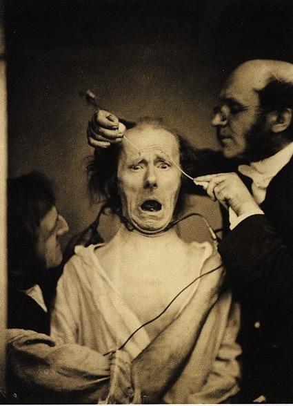 0Guillaume_Duchenne_de_Boulogne_performing_facial_electrostimulus_experiments.jpg