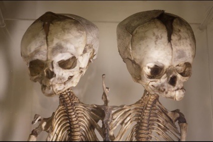 0bartsmuseum0skullsglobalpost3.jpg