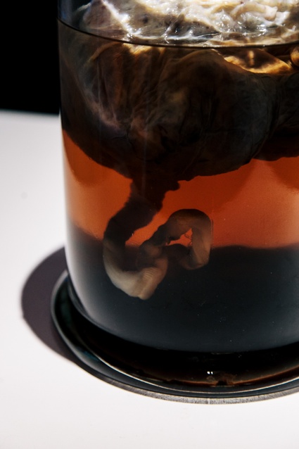 A human placenta from 'Stem Cell Transplantation' by Shaun McCann as part of BLOOD at Science Gallery at Trinity College Dublin 1.jpg