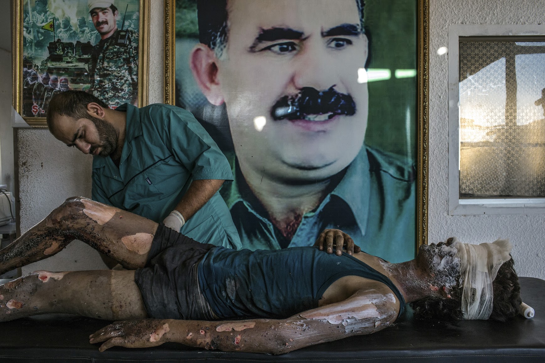 3. Hasaka, Syria - August 1, 2015A doctor rubs ointment on the burns of Jacob, 16, in front of a poster of Abdullah Ocalan, center, the jailed leader of the Kurdistan Workers' Party, at a YPG hospital compound on the outskirts of Hasaka. According to YPG fighters at the scene, Jacob is an ISIS fighter from Deir al-Zour and the only survivior from an ambush made by YPG fighters over a truck alleged to carry ISIS fighters on the outskirts of Hasaka. Six ISIS fighters died in the attack, 5 of them completely disfigured by the explosion.